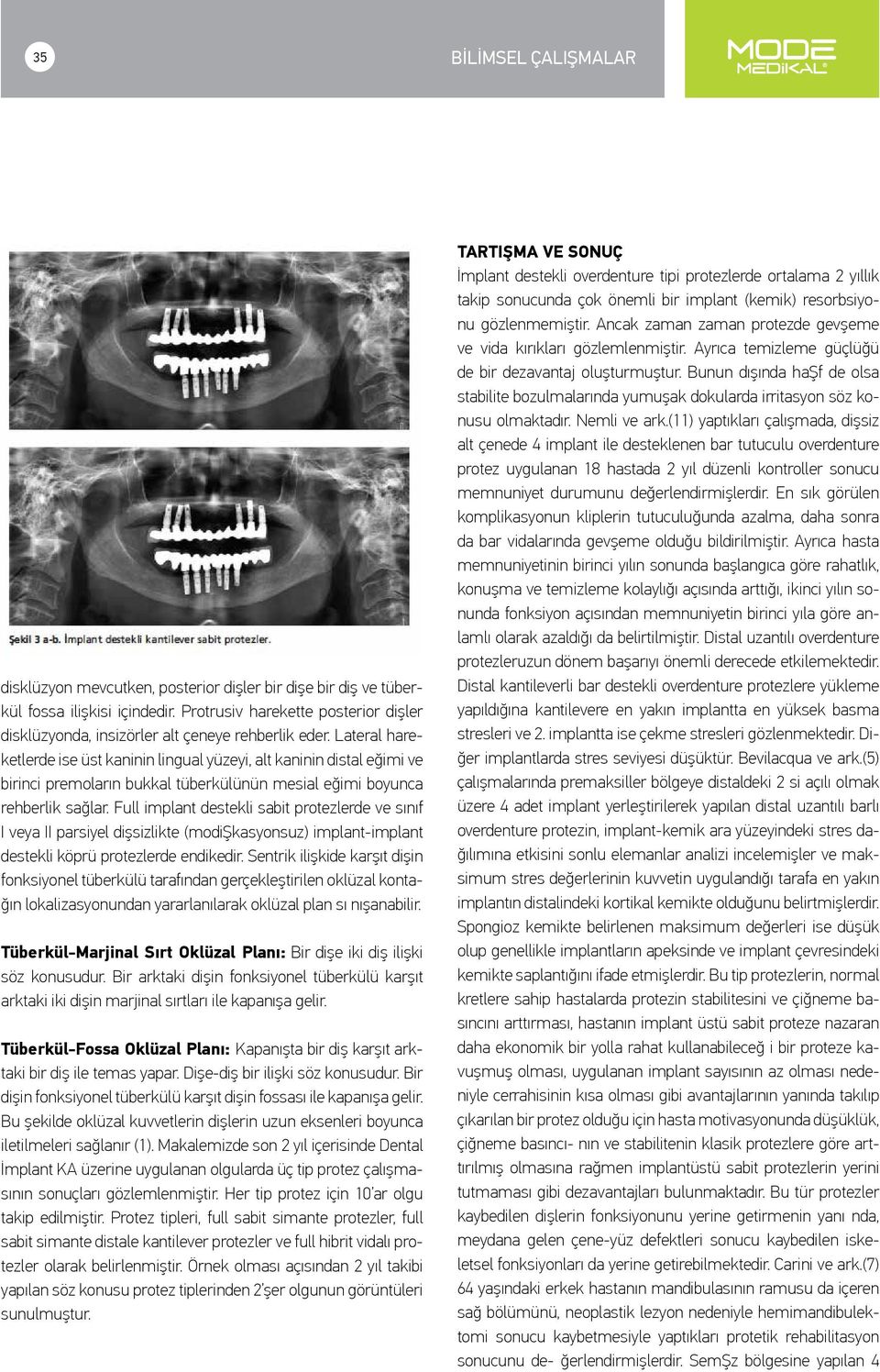 Lateral hareketlerde ise üst kaninin lingual yüzeyi, alt kaninin distal eğimi ve birinci premoların bukkal tüberkülünün mesial eğimi boyunca rehberlik sağlar.