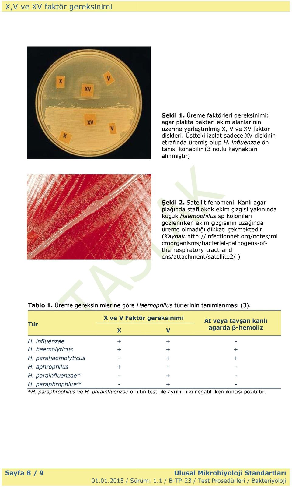 Kanlı agar plağında stafilokok ekim çizgisi yakınında küçük Haemophilus sp kolonileri gözlenirken ekim çizgisinin uzağında üreme olmadığı dikkati çekmektedir. (Kaynak:http://infectionnet.