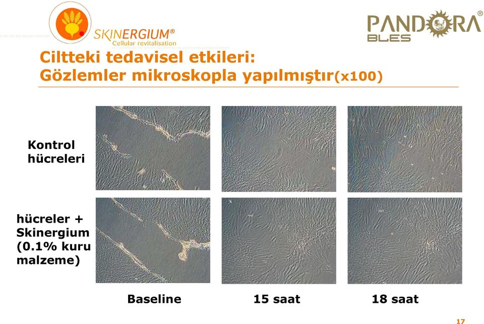 hücreleri hücreler + Skinergium (0.