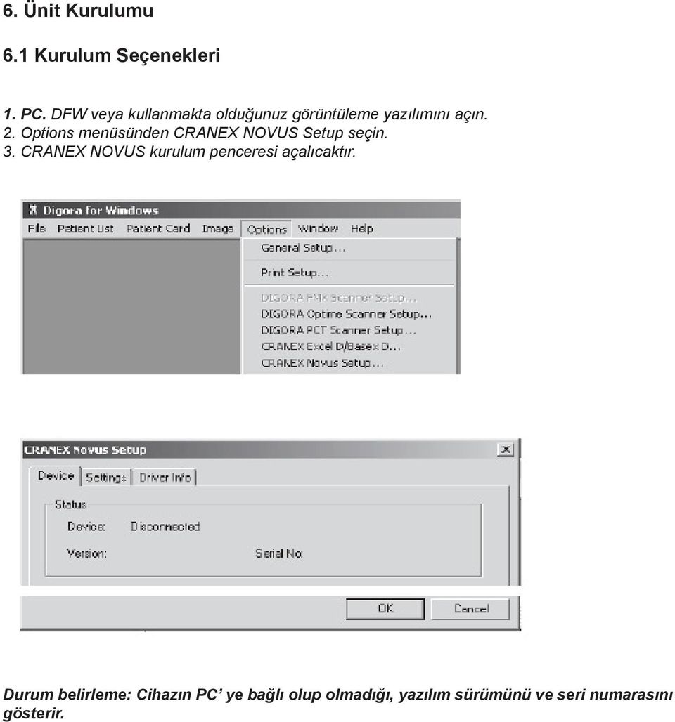 Options menüsünden CRANEX NOVUS Setup seçin. 3.