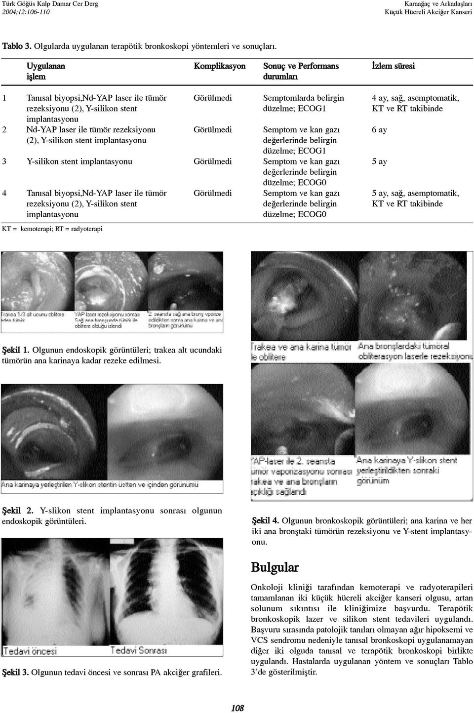 stent düzelme; ECOG1 KT ve RT takibinde implantasyonu 2 Nd-YAP laser ile tümör rezeksiyonu Görülmedi Semptom ve kan gazý 6 ay (2), Y-silikon stent implantasyonu deðerlerinde belirgin düzelme; ECOG1 3