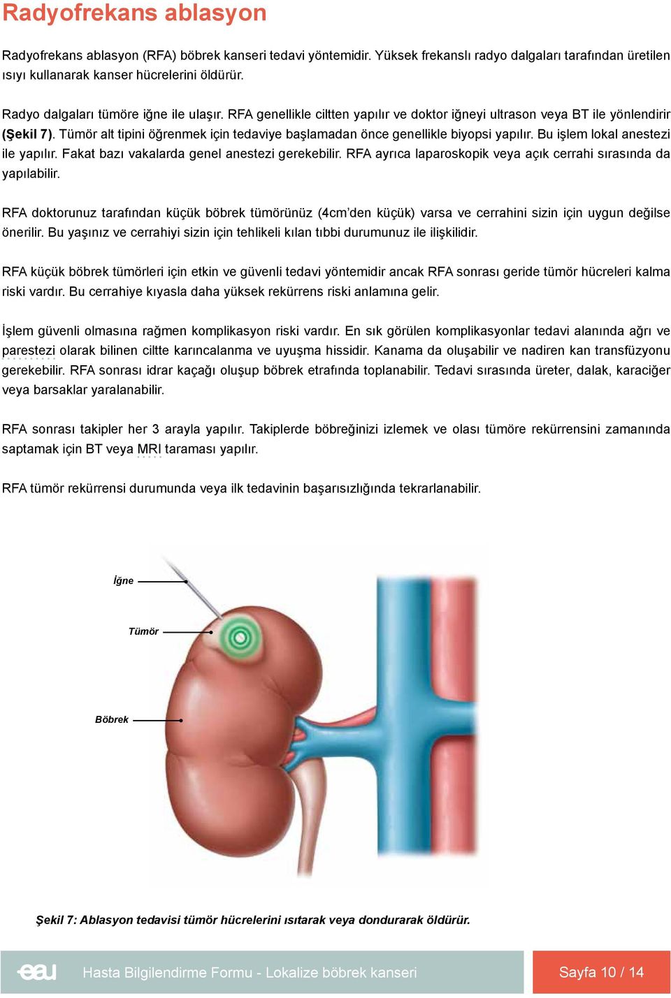 Tümör alt tipini öğrenmek için tedaviye başlamadan önce genellikle biyopsi yapılır. Bu işlem lokal anestezi ile yapılır. Fakat bazı vakalarda genel anestezi gerekebilir.