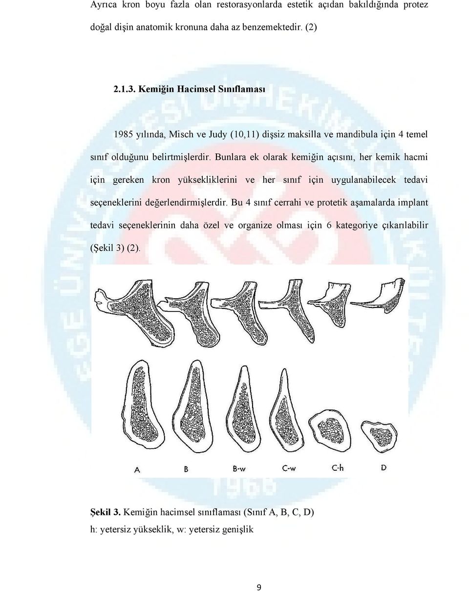 Bunlara ek olarak kemiğin açısını, her kemik hacmi için gereken kron yüksekliklerini ve her sınıf için uygulanabilecek tedavi seçeneklerini değerlendirmişlerdir.