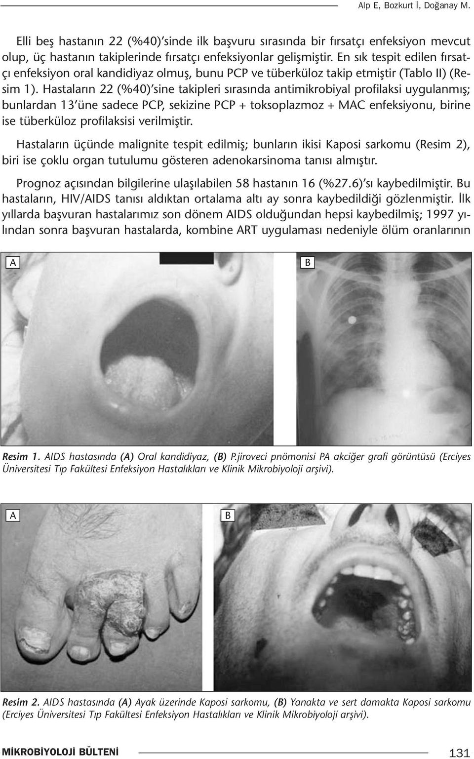 Hastaların 22 (%40) sine takipleri sırasında antimikrobiyal profilaksi uygulanmış; bunlardan 13 üne sadece PCP, sekizine PCP + toksoplazmoz + MAC enfeksiyonu, birine ise tüberküloz profilaksisi