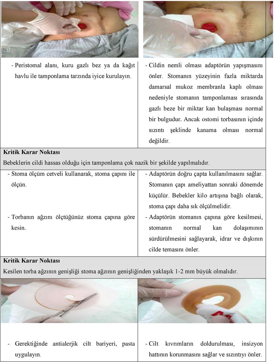 Ancak ostomi torbasının içinde sızıntı şeklinde kanama olması normal değildir. Bebeklerin cildi hassas olduğu için tamponlama çok nazik bir şekilde yapılmalıdır.