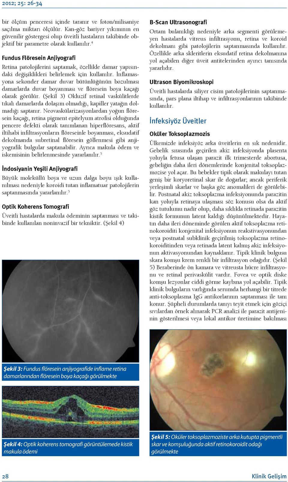 4 Fundus Flöresein Anjiyografi Retina patolojilerini saptamak, özellikle damar yapısındaki değişiklikleri belirlemek için kullanılır.