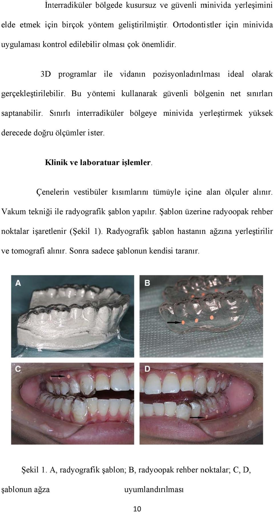 Sınırlı interradiküler derecede doğru ölçümler ister. bölgeye minivida m yerleştirmek yüksek Klinik ve laboratuar işlemler. Çenelerin vestibüler kısımlarını tümüyle içine alan ölçuler alınır.