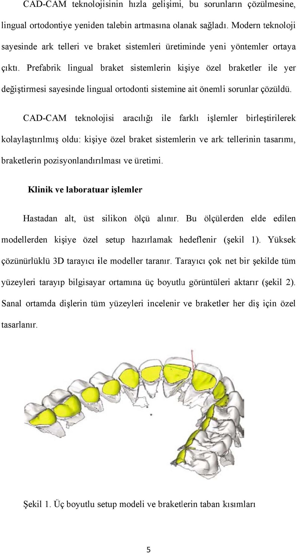 Prefabrik lingual braket sistemlerin kişiye k özel braketler ile yer değiştirmesi sayesinde lingual ortodonti sistemine ait önemlii sorunlar çözüldü.