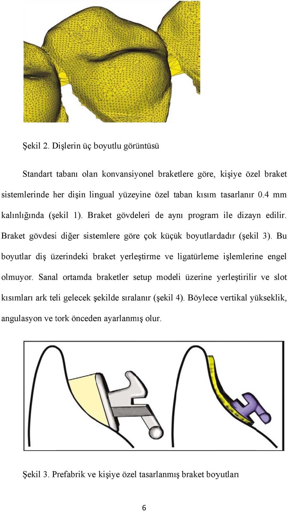 0.4 mm kalınlığında (şekil 1). Braket gövdeleri de aynı programm ile dizayn edilir. Braket gövdesii diğer sistemlere göre çok küçük boyutlardadır (şekil 3).