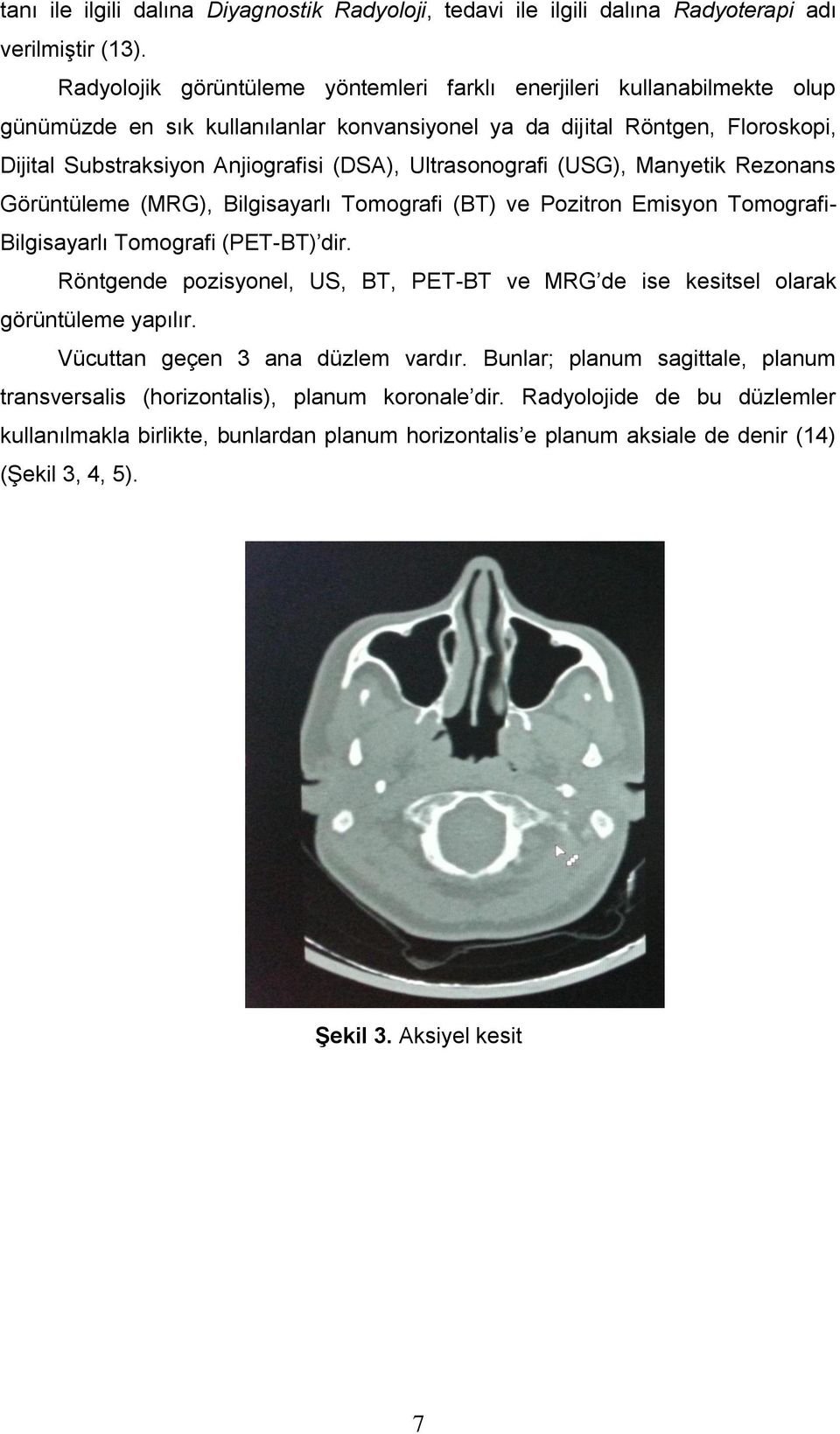 Ultrasonografi (USG), Manyetik Rezonans Görüntüleme (MRG), Bilgisayarlı Tomografi (BT) ve Pozitron Emisyon Tomografi- Bilgisayarlı Tomografi (PET-BT) dir.