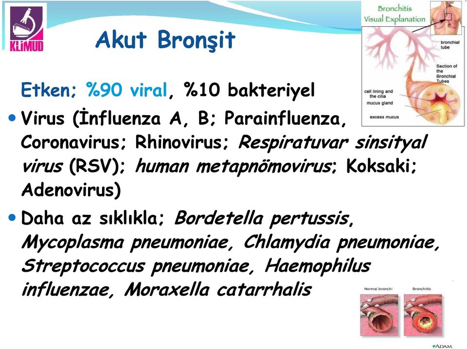 Koksaki; Adenovirus) Daha az sıklıkla; Bordetella pertussis, Mycoplasma pneumoniae,