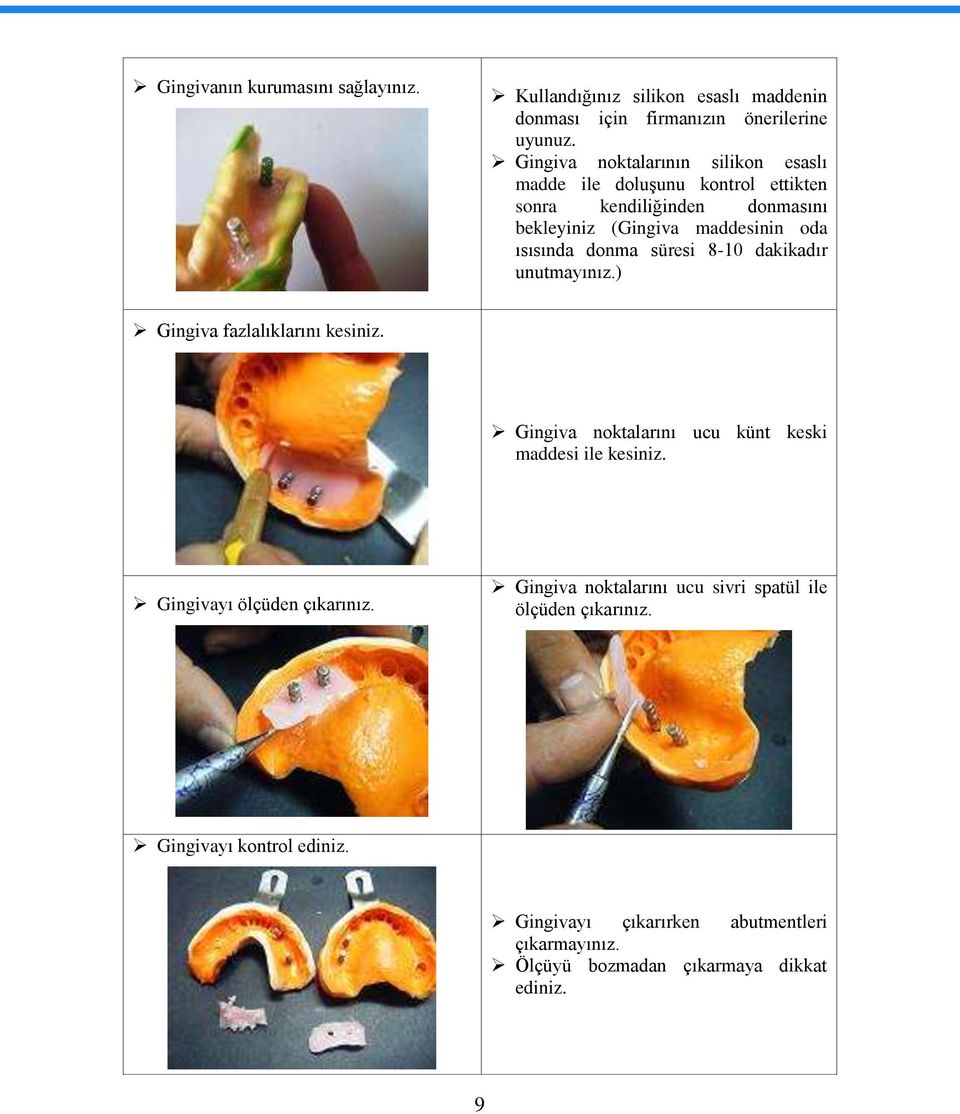 donma süresi 8-10 dakikadır unutmayınız.) Gingiva fazlalıklarını kesiniz. Gingiva noktalarını ucu künt keski maddesi ile kesiniz.