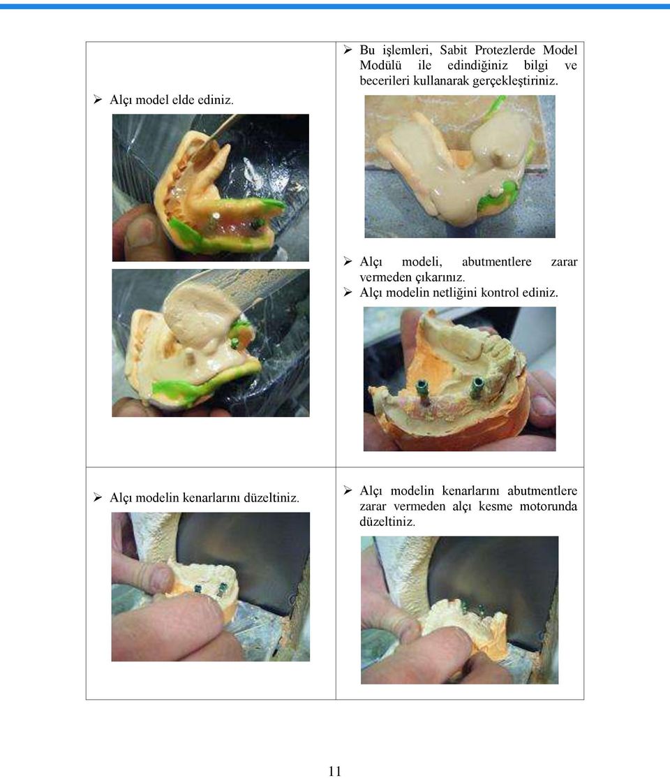 kullanarak gerçekleģtiriniz. Alçı modeli, abutmentlere zarar vermeden çıkarınız.