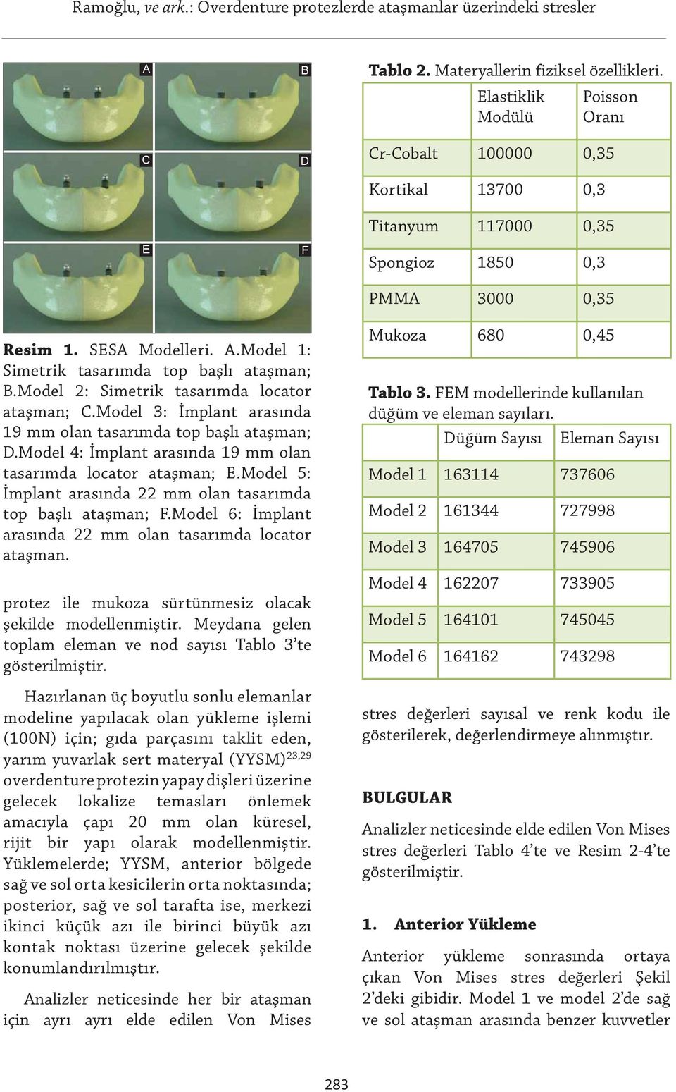 Model 4: İmplant arasında 19 mm olan tasarımda locator ataşman; E.Model 5: İmplant arasında 22 mm olan tasarımda top başlı ataşman; F.Model 6: İmplant arasında 22 mm olan tasarımda locator ataşman.