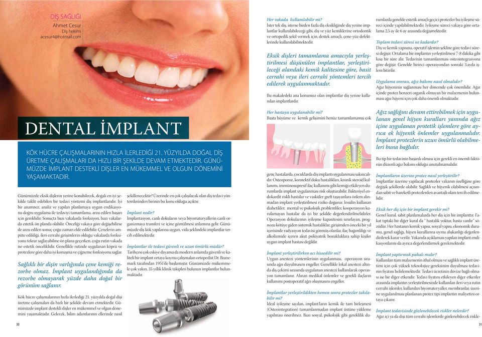 Günümüzde eksik dişlerin yerine konabilecek, doğalı en iyi şekilde taklit edebilen bir tedavi yöntemi diş implantlarıdır.