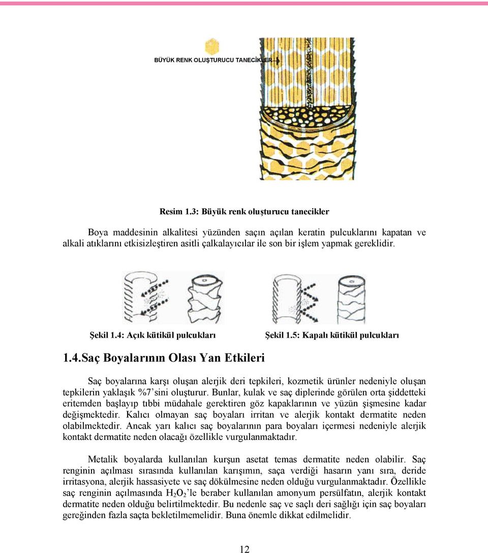 gereklidir. Şekil 1.4: Açık kütikül pulcukları Şekil 1.5: Kapalı kütikül pulcukları 1.4.Saç Boyalarının Olası Yan Etkileri Saç boyalarına karşı oluşan alerjik deri tepkileri, kozmetik ürünler nedeniyle oluşan tepkilerin yaklaşık %7 sini oluşturur.