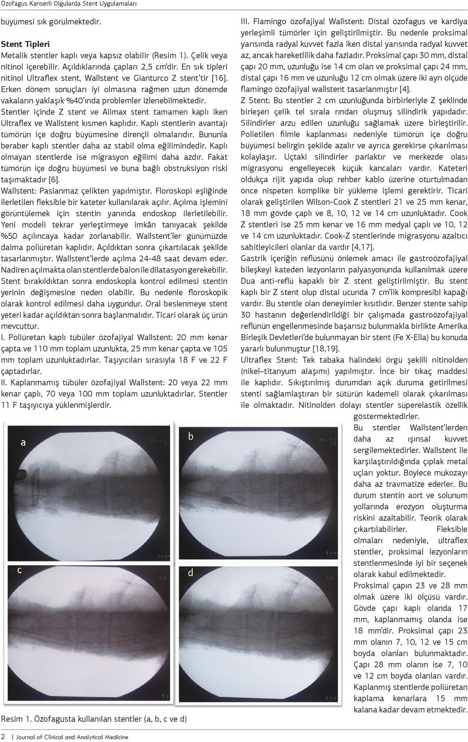 Stentler içinde Z stent ve Alimax stent tamamen kaplı iken Ultraflex ve Wallstent kısmen kaplıdır. Kaplı stentlerin avantajı tümörün içe doğru büyümesine dirençli olmalarıdır.