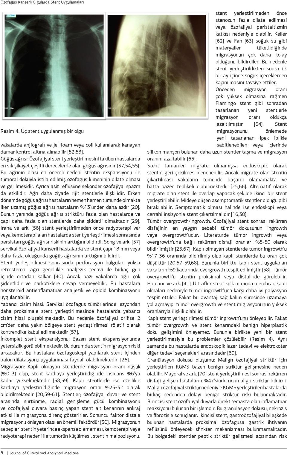 Bu ağrının olası en önemli nedeni stentin ekspansiyonu ile tümöral dokuyla istila edilmiş özofagus lümeninin dilate olması ve gerilmesidir.