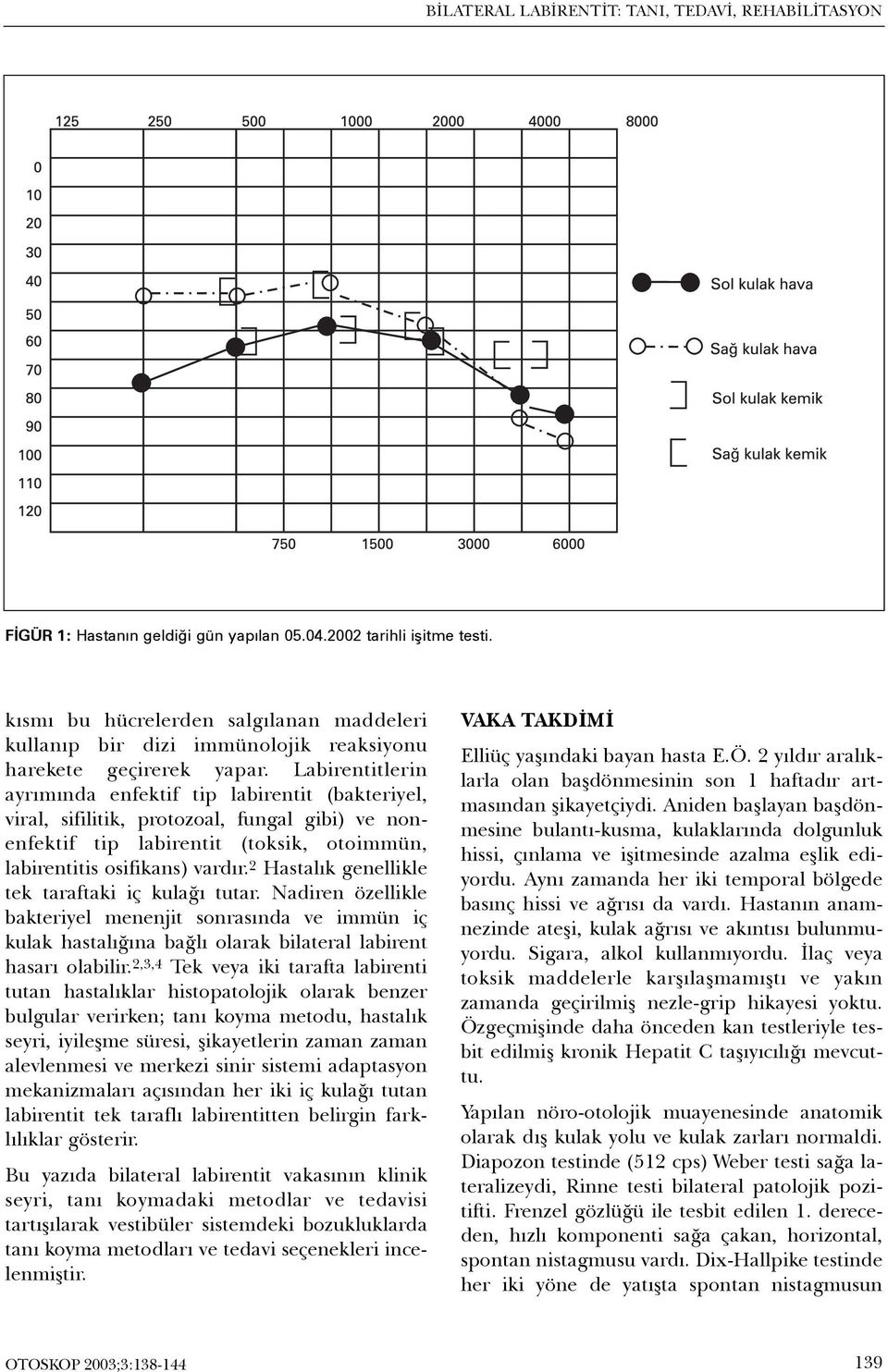 Labirentitlerin ayrýmýnda enfektif tip labirentit (bakteriyel, viral, sifilitik, protozoal, fungal gibi) ve nonenfektif tip labirentit (toksik, otoimmün, labirentitis osifikans) vardýr.