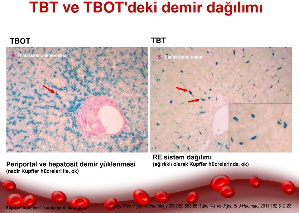 olarak Küpffer hücrelerinde, ok) Küpffer hücreleri = karaciğer makrofajları