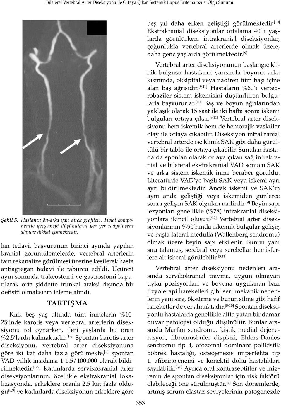 Üçüncü ayın sonunda trakeostomi ve gastrostomi kapatılarak orta şiddette trunkal ataksi dışında bir defisiti olmaksızın izleme alındı.