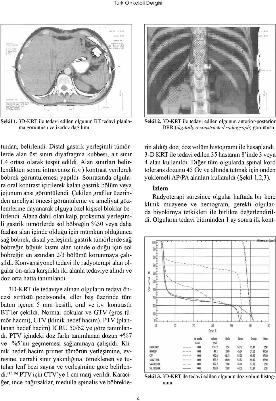 Distal gastrik yerleşimli tümörlerde alan üst sınırı diyafragma kubbesi, alt sınır L4 ortası olarak tespit edildi. Alan sınırları belirlendikten sonra intrave