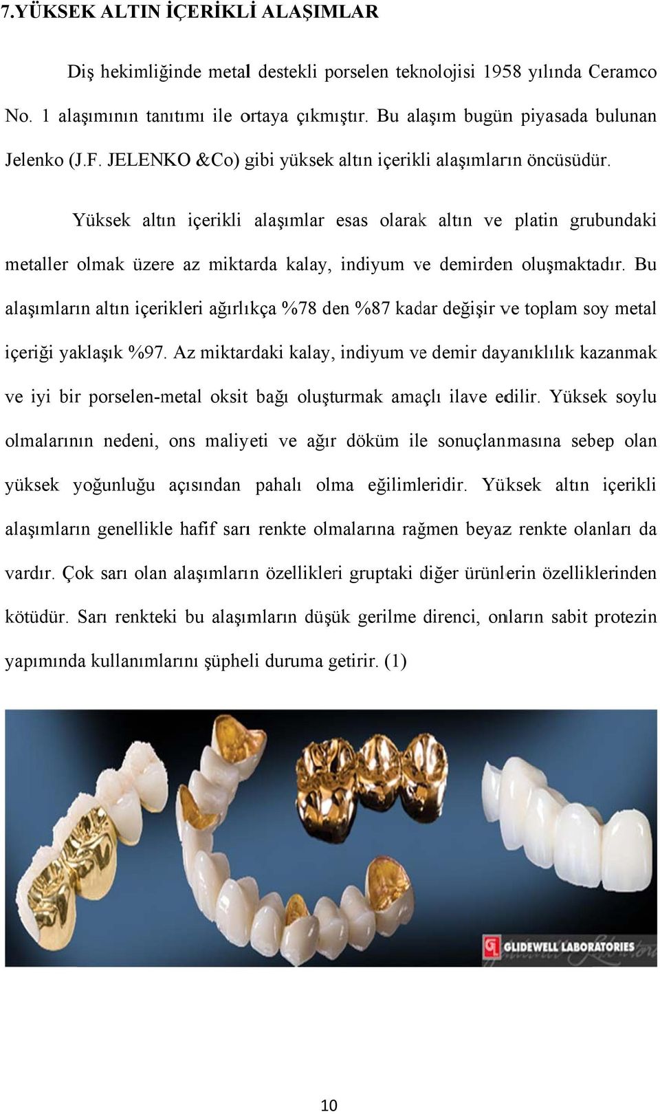 Yüksek altın içerikli alaşımlar esas olarakk altın ve platin grubundaki metaller olmak üzere az miktarda kalay, indiyum ve v demirdenn oluşmaktadır.