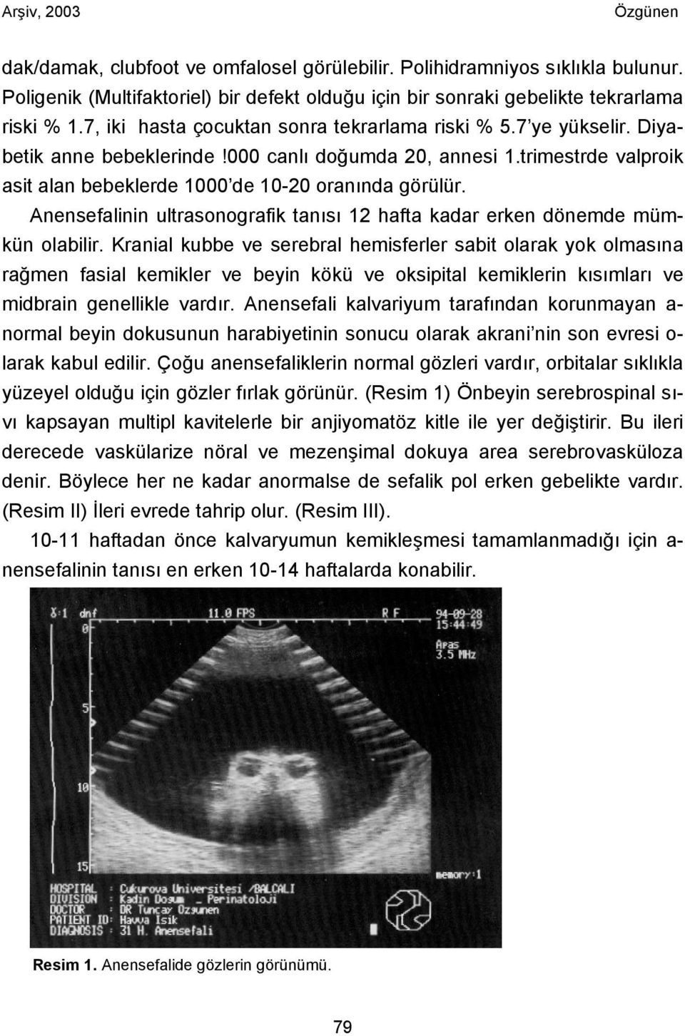 Anensefalinin ultrasonografik tanısı 12 hafta kadar erken dönemde mümkün olabilir.