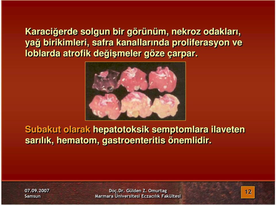 atrofik değişmeler göze çarpar.