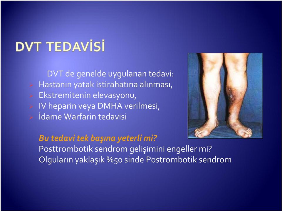 Warfarin tedavisi Bu tedavi tek başına yeterli mi?