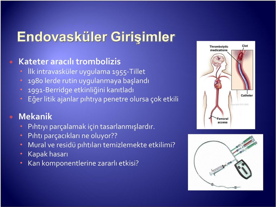 olursa çok etkili Mekanik Pıhtıyı parçalamak için tasarlanmışlardır.