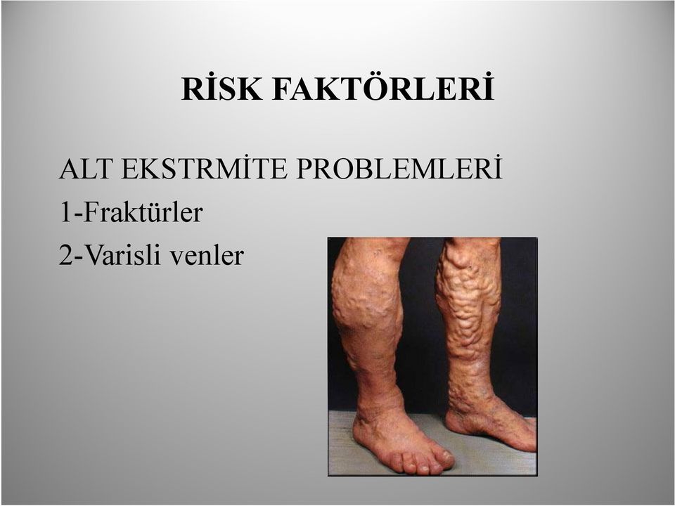 PROBLEMLERİ