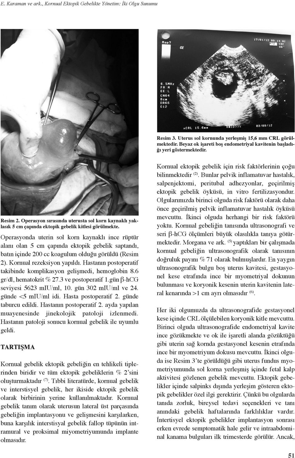 Operasyonda uterin sol korn kaynaklı ince rüptür alanı olan 5 cm çapında ektopik gebelik saptandı, batın içinde 200 cc koagulum olduğu görüldü (Resim 2). Kornual rezeksiyon yapıldı.