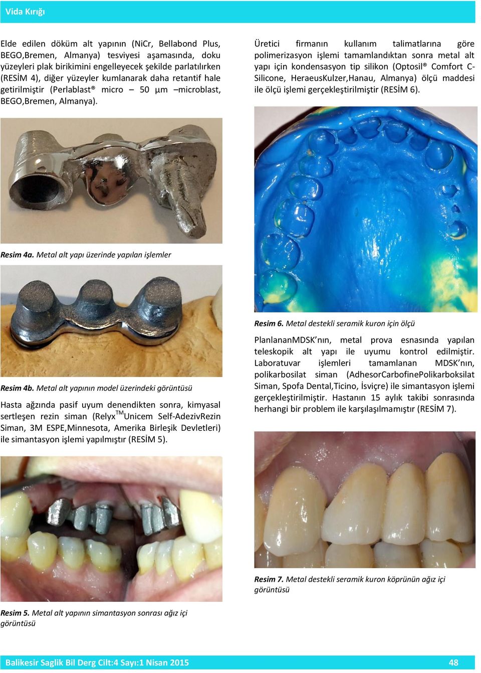 Üretici firmanın kullanım talimatlarına göre polimerizasyon işlemi tamamlandıktan sonra metal alt yapı için kondensasyon tip silikon (Optosil Comfort C- Silicone, HeraeusKulzer,Hanau, Almanya) ölçü