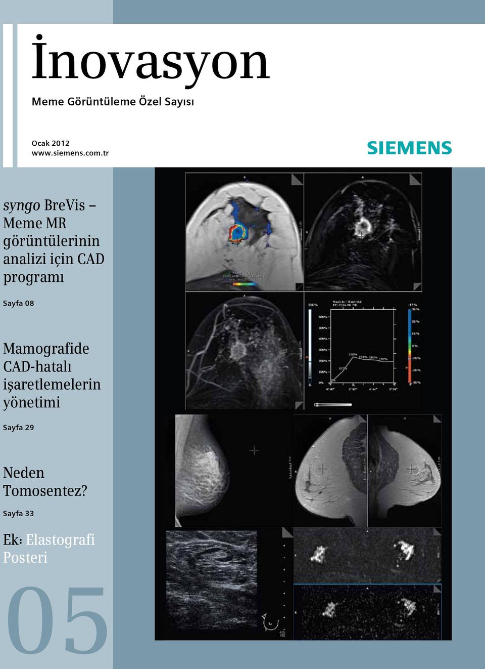 programı Sayfa 08 Mamografide CAD-hatalı işaretlemelerin
