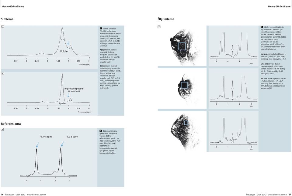 kullanılarak alındı. 0,9 ve,3 de lipidlerden belirgin sinyaller gelir. B) Spektrum, manual simleme programının da eklenmesi suretiyle alındı.