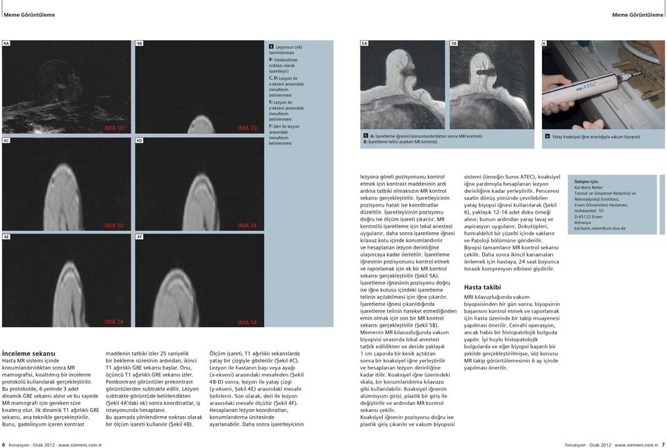 vakum biyopsisi E İnceleme sekansı Hasta MR sistemi içinde konumlandırıldıktan sonra MR mamografisi, kısaltılmış bir inceleme protokolü kullanılarak gerçekleştirilir.