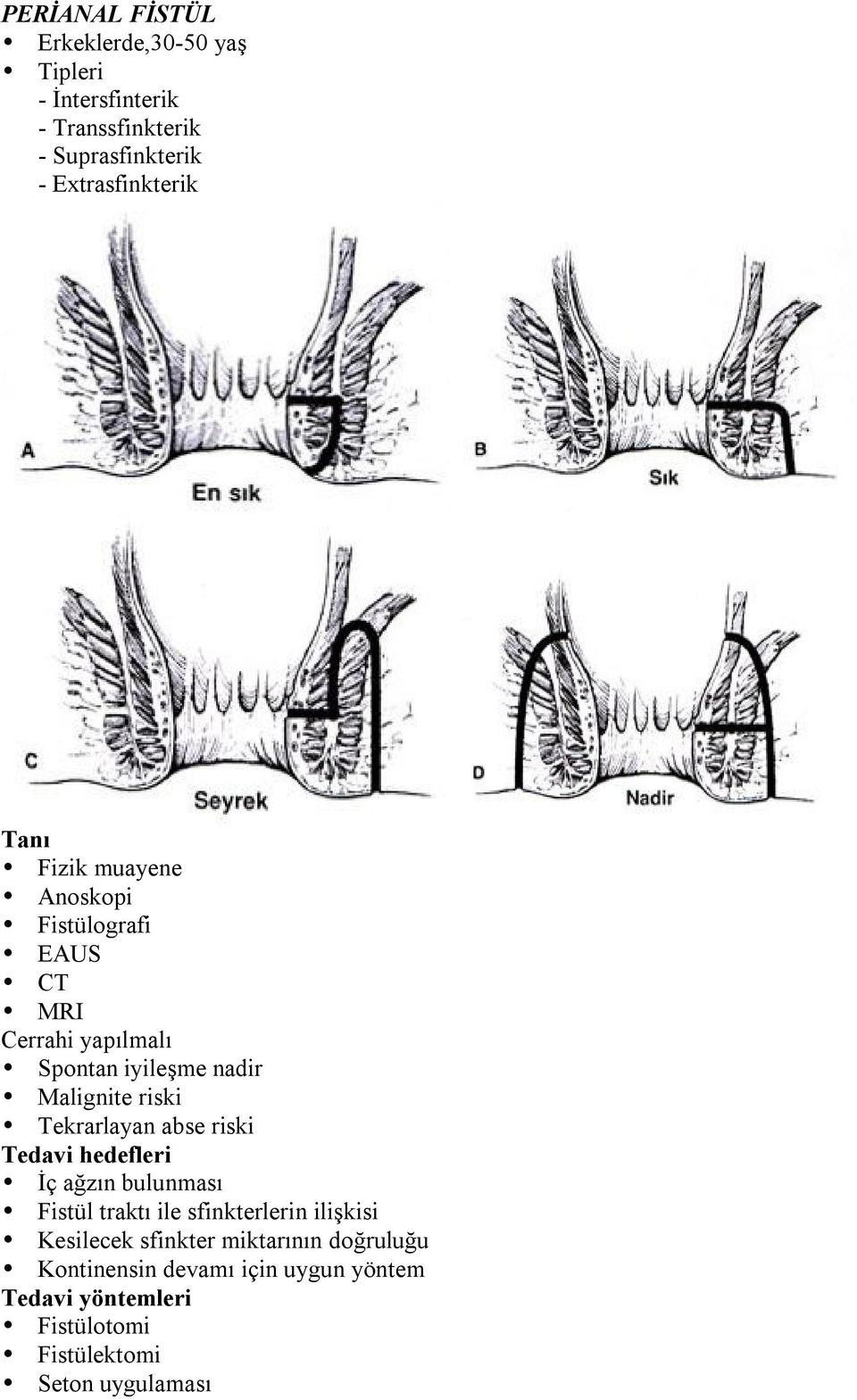 Tekrarlayan abse riski Tedavi hedefleri İç ağzın bulunması Fistül traktı ile sfinkterlerin ilişkisi Kesilecek