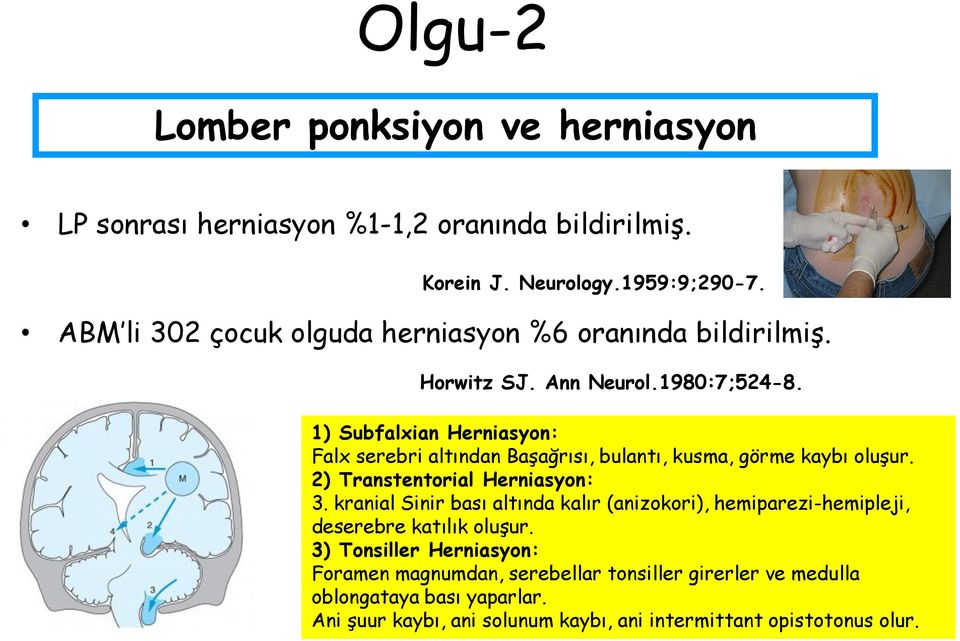 1) Subfalxian Herniasyon: Falx serebri altından Başağrısı, bulantı, kusma, görme kaybı oluşur. 2) Transtentorial Herniasyon: 3.