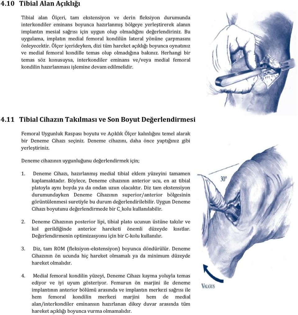 Ölçer içerideyken, dizi tüm hareket açıklığı boyunca oynatınız ve medial femoral kondille temas olup olmadığına bakınız.