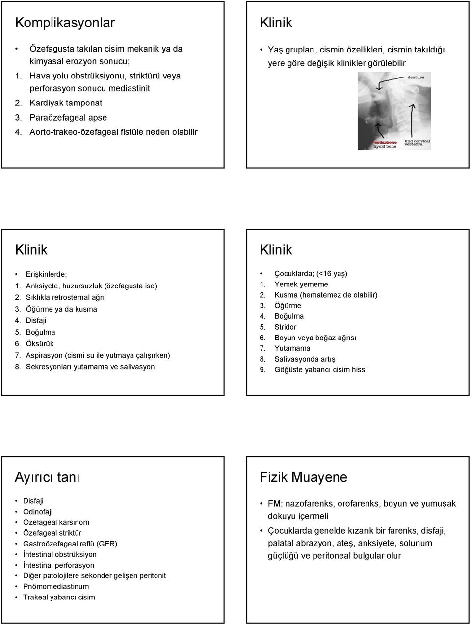 Anksiyete, huzursuzluk (özefagusta ise) 2. Sıklıkla retrosternal ağrı 3. Öğürme ya da kusma 4. Disfaji 5. Boğulma 6. Öksürük 7. Aspirasyon (cismi su ile yutmaya çalışırken) 8.