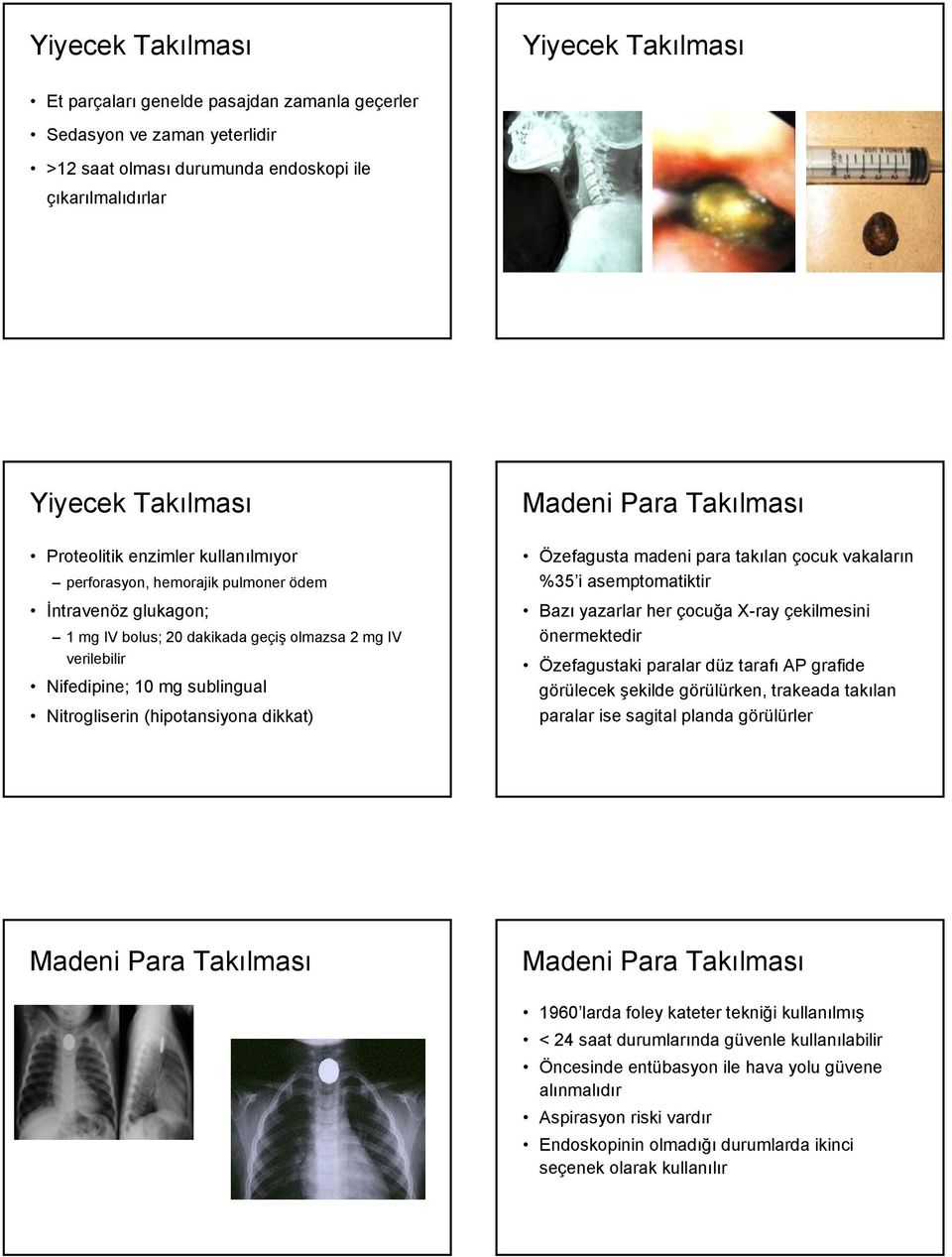 dikkat) Madeni Para Takılması Özefagusta madeni para takılan çocuk vakaların %35 i asemptomatiktir Bazı yazarlar her çocuğa X-ray çekilmesini önermektedir Özefagustaki paralar düz tarafı AP grafide