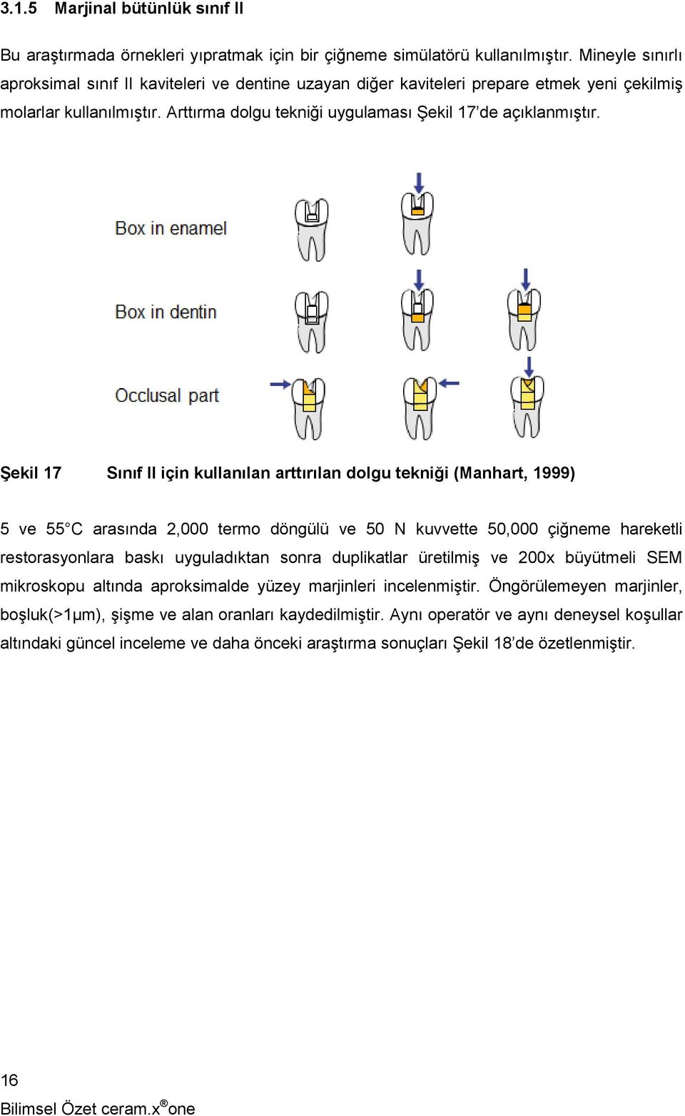 Şekil 17 Sınıf II için kullanılan arttırılan dolgu tekniği (Manhart, 1999) 5 ve 55 C arasında 2,000 termo döngülü ve 50 N kuvvette 50,000 çiğneme hareketli restorasyonlara baskı uyguladıktan sonra