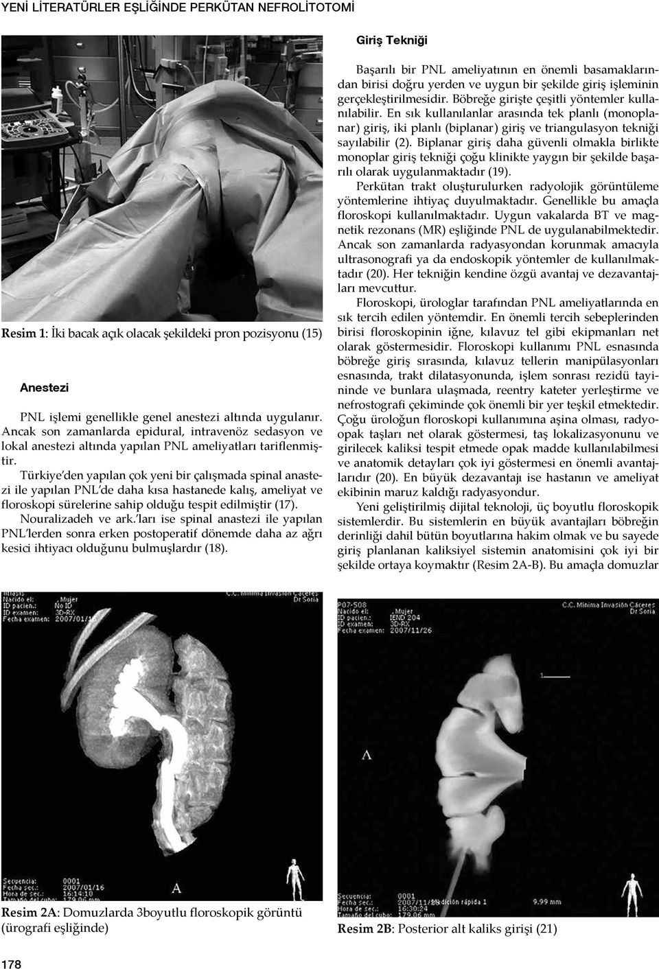 Türkiye den yapılan çok yeni bir çalışmada spinal anastezi ile yapılan PNL de daha kısa hastanede kalış, ameliyat ve floroskopi sürelerine sahip olduğu tespit edilmiştir (17). Nouralizadeh ve ark.