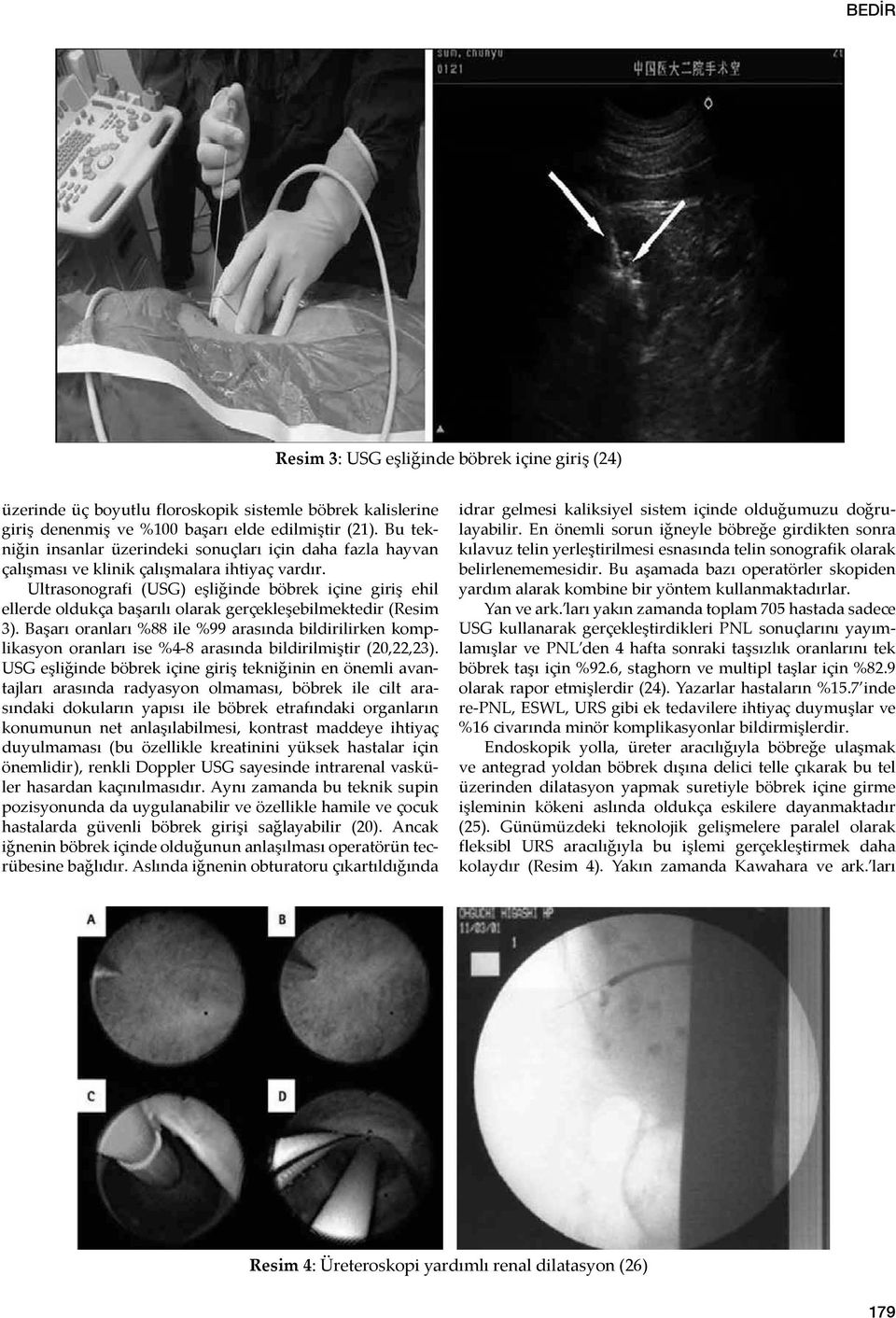 Ultrasonografi (USG) eşliğinde böbrek içine giriş ehil ellerde oldukça başarılı olarak gerçekleşebilmektedir (Resim 3).