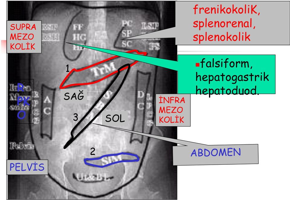 SAĞ 3 SOL İNFRA MEZO KOLİK