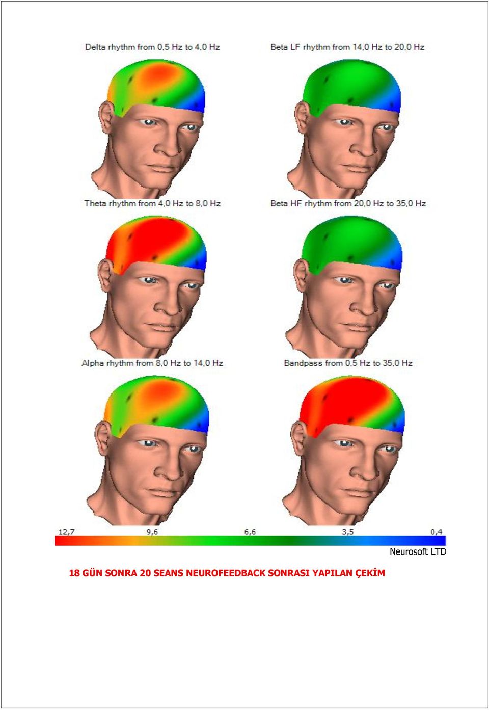 NEUROFEEDBACK