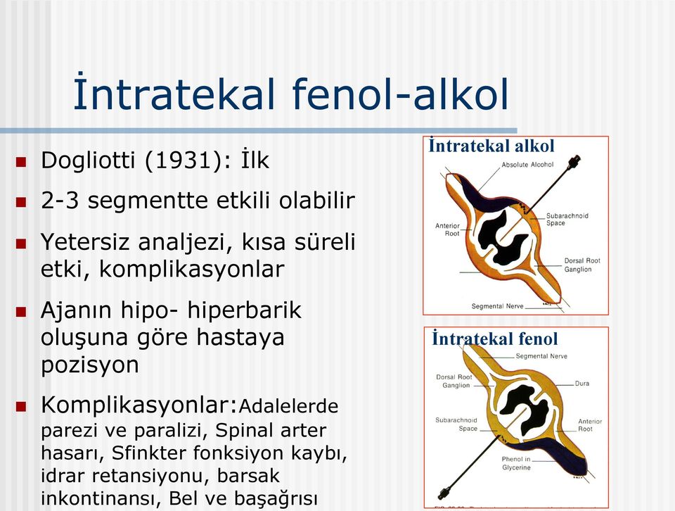 Dogliotti (1931): İlk 2-3 segmentte etkili olabilir İntratekal alkol Yetersiz analjezi,