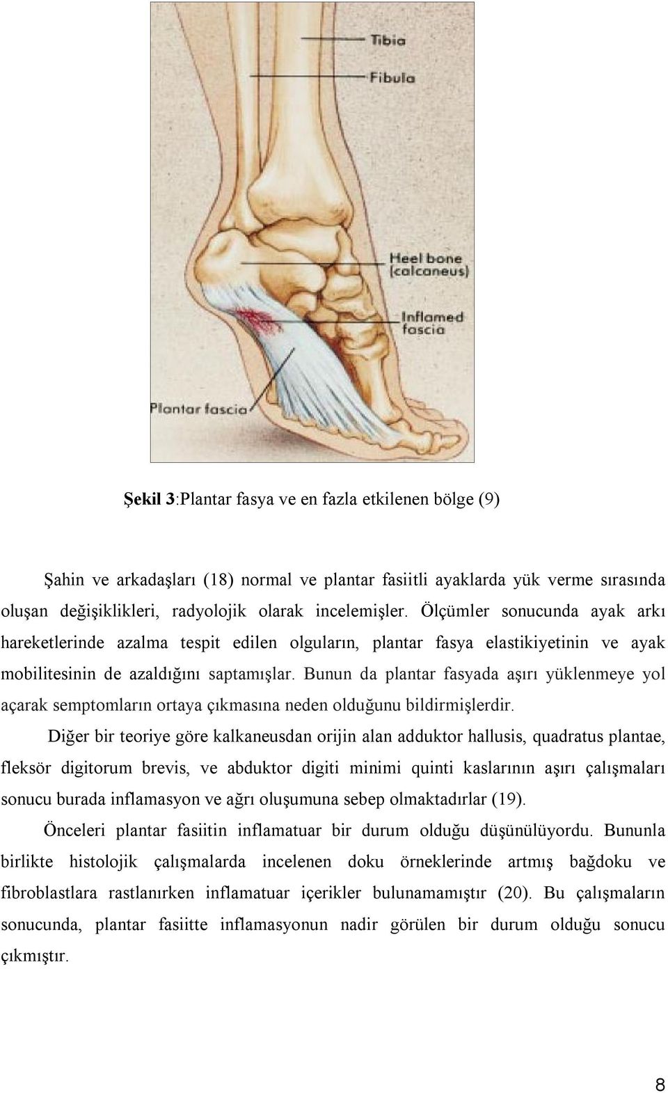 Bunun da plantar fasyada aşırı yüklenmeye yol açarak semptomların ortaya çıkmasına neden olduğunu bildirmişlerdir.