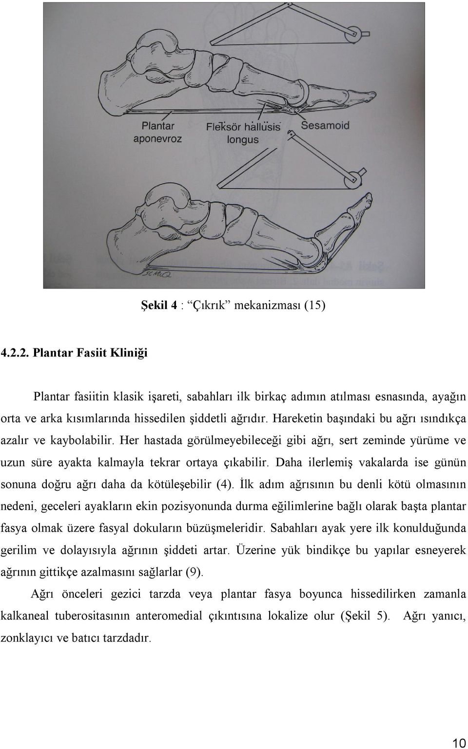 Hareketin başındaki bu ağrı ısındıkça azalır ve kaybolabilir. Her hastada görülmeyebileceği gibi ağrı, sert zeminde yürüme ve uzun süre ayakta kalmayla tekrar ortaya çıkabilir.